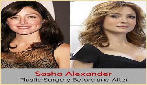 Sasha Alexander Plastic Surgery Before and After